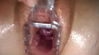 Taboo Hentai Schoolgirl Fucked Inside A Gyno Speculum | freckledRED